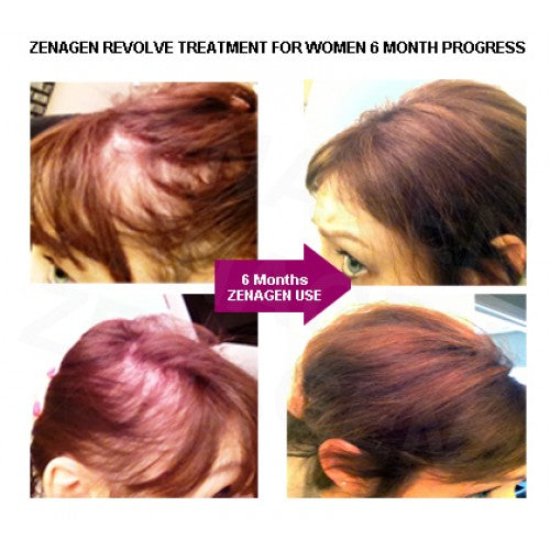 Zenagen Revolve Women's Thickening Shampoo