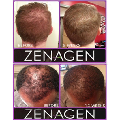 Zenagen Revolve Treatment for Men