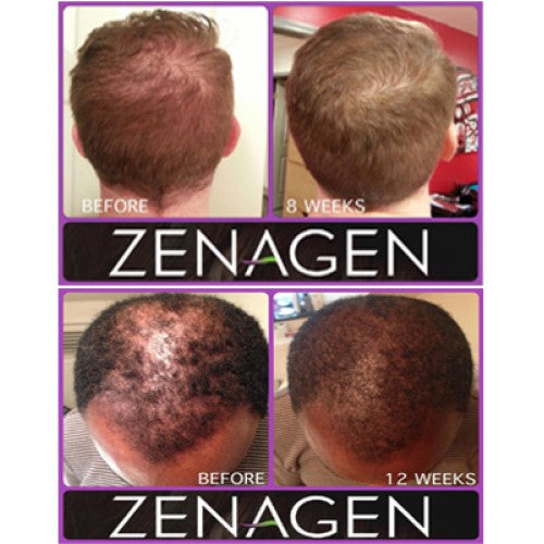 Zenagen Revolve Men's Thickening Shampoo